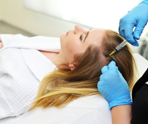 Trattamento PRP per i Capelli