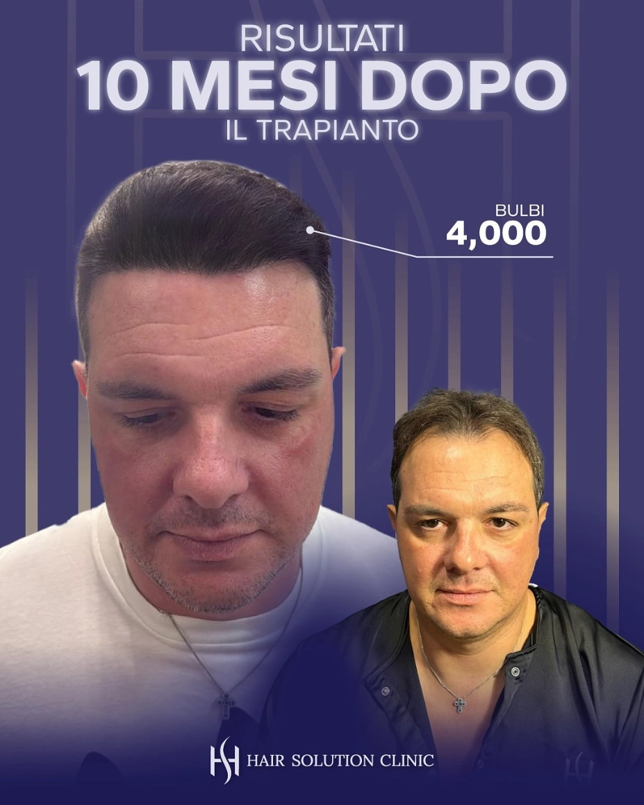 Risultato 10 Mesi