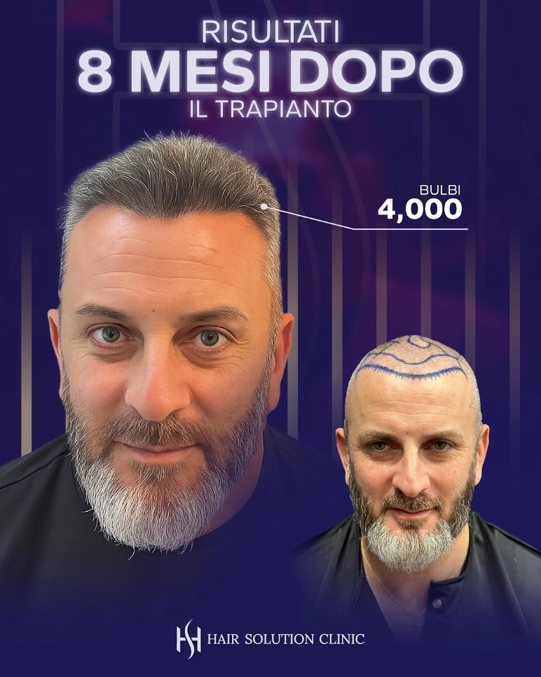 Risultato 8 Mesi
