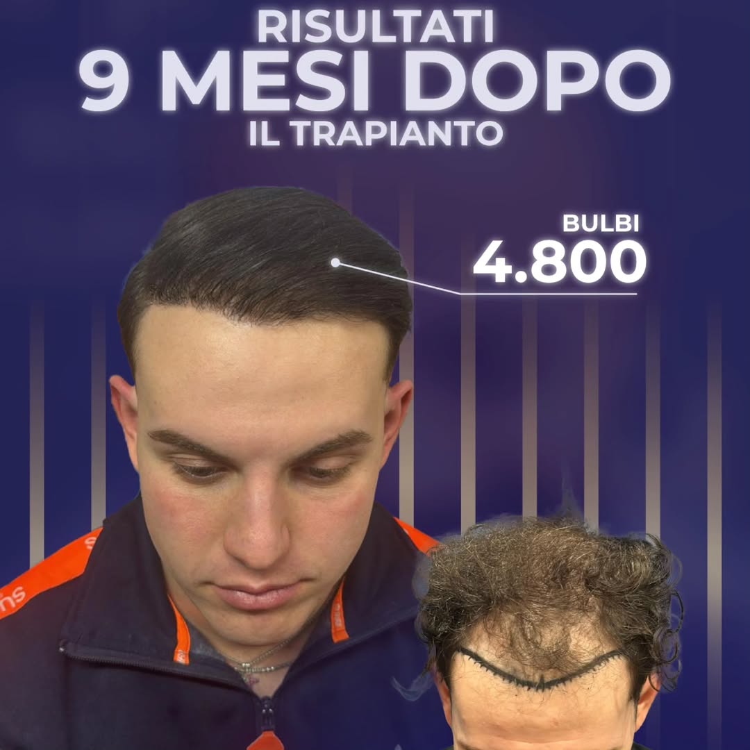 Risultato 9 Mesi